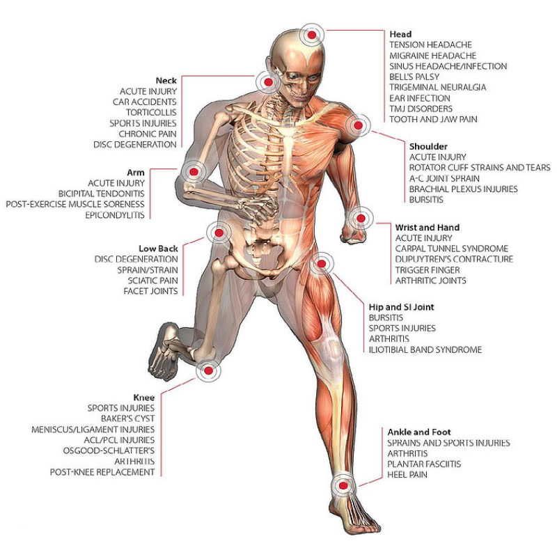 Diagram of The human body and the injuries related to the joints